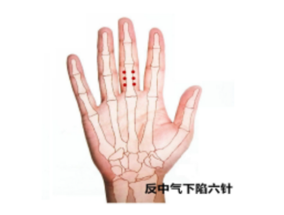 抗癌、治癌三大针法大公开