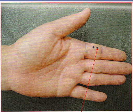 董氏奇穴-小间穴