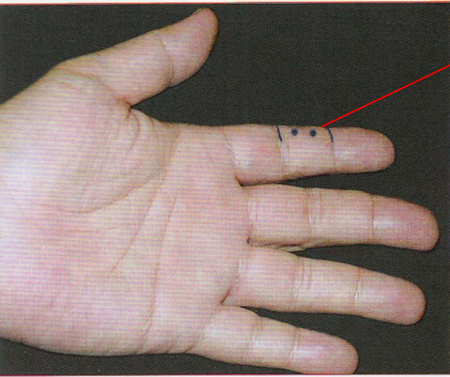 董氏奇穴-浮间穴