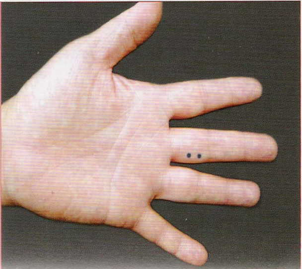 董氏奇穴-心常穴