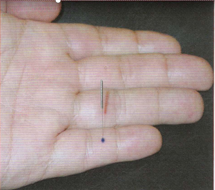 董氏奇穴-眼黄穴